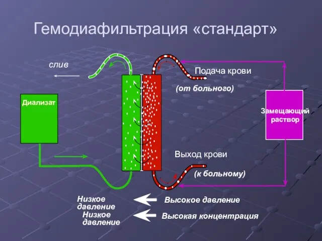 Гемодиафильтрация «стандарт»