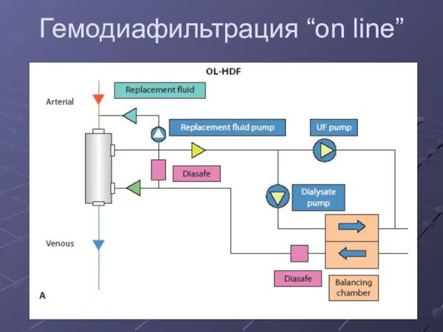 Гемодиафильтрация “on line”