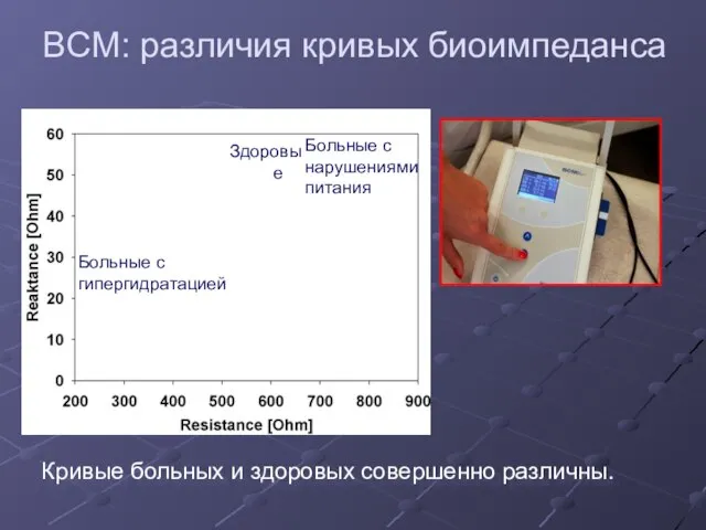 BCM: различия кривых биоимпеданса Здоровые Больные с нарушениями питания Больные с