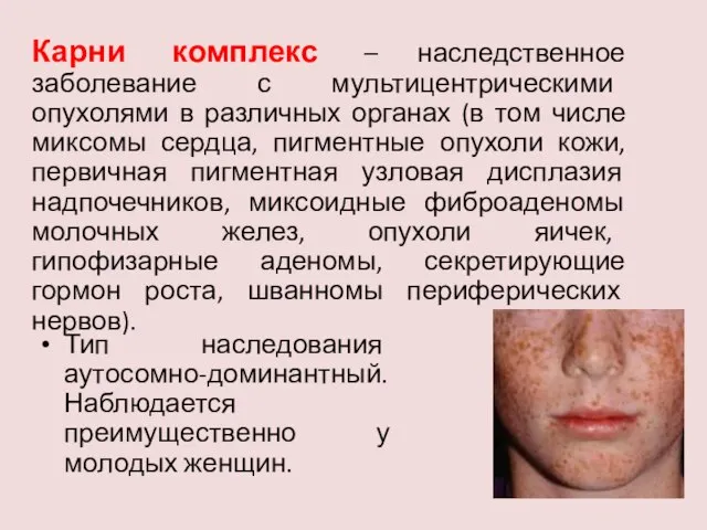 Карни комплекс – наследственное заболевание с мультицентрическими опухолями в различных органах