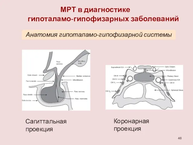 МРТ в диагностике гипоталамо-гипофизарных заболеваний Анатомия гипоталамо-гипофизарной системы Сагиттальная проекция Коронарная проекция