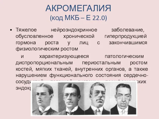 АКРОМЕГАЛИЯ (код МКБ – Е 22.0) Тяжелое нейроэндокринное заболевание, обусловленное хронической