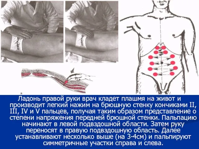 Ладонь правой руки врач кладет плашмя на живот и производит легкий