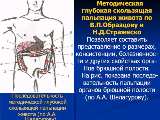 Последовательность методической глубокой скользящей пальпации живота (по А.А. Шелагурову) Методическая глубокая