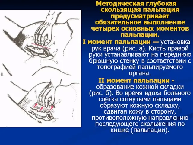 Методическая глубокая скользящая пальпация предусматривает обязательное выполнение четырех основных моментов пальпации.