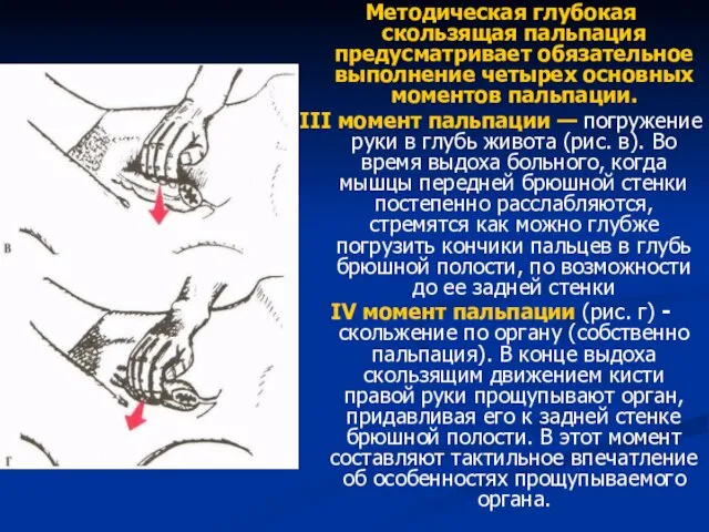 Методическая глубокая скользящая пальпация предусматривает обязательное выполнение четырех основных моментов пальпации.