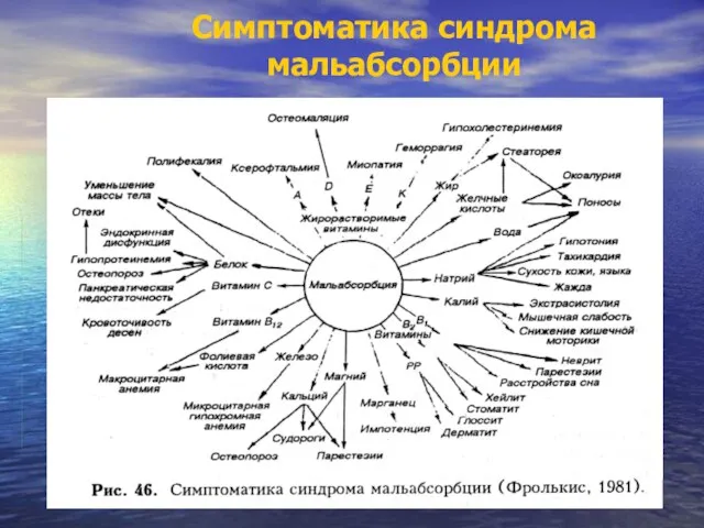 Симптоматика синдрома мальабсорбции