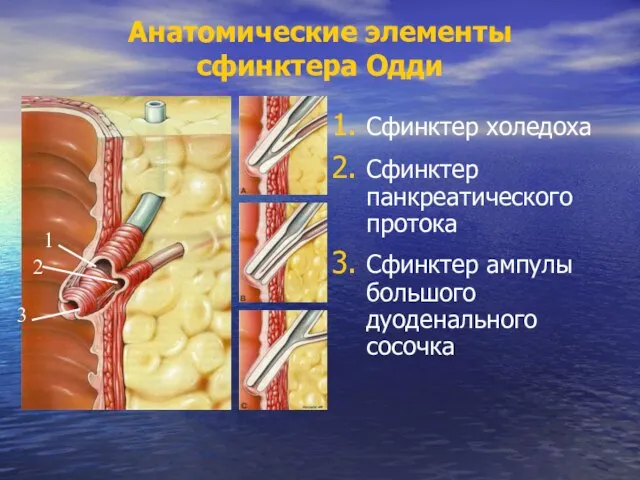 Анатомические элементы сфинктера Одди Сфинктер холедоха Сфинктер панкреатического протока Сфинктер ампулы