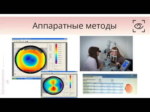 Аппаратные методы Ортокератология