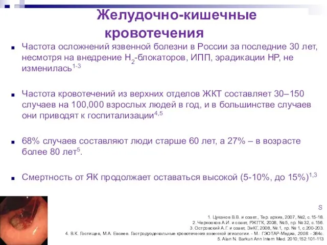 Желудочно-кишечные кровотечения Частота осложнений язвенной болезни в России за последние 30