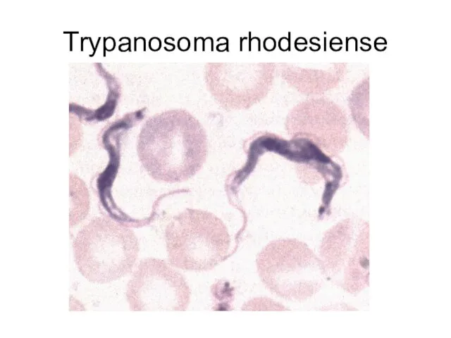 Trypanosoma rhodesiense