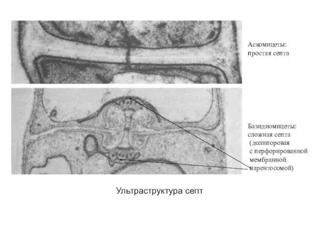 Ультраструктура септ Аскомицеты: простая септа Базидиомицеты: сложная септа (долипоровая с перфорированной мембранной парентосомой)