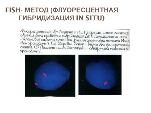 FISH- МЕТОД (ФЛУОРЕСЦЕНТНАЯ ГИБРИДИЗАЦИЯ IN SITU)