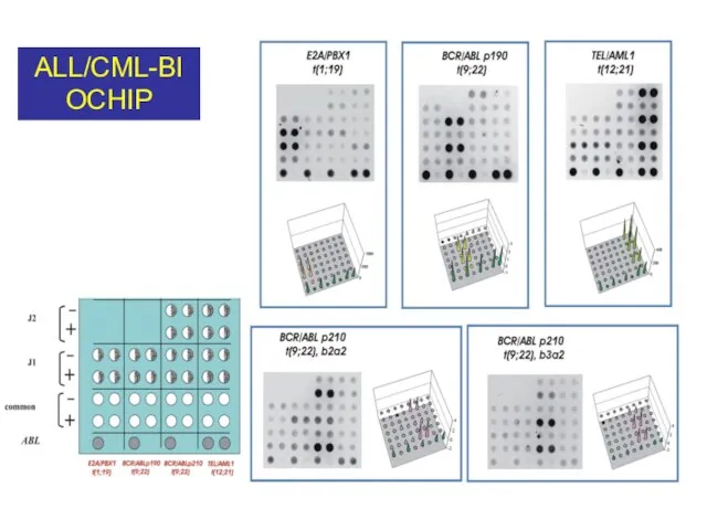 ALL/CML-BIOCHIP