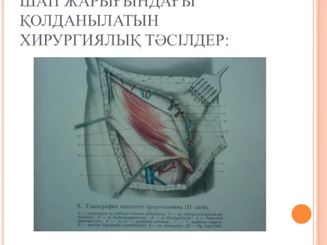 ШАП ЖАРЫҒЫНДАҒЫ ҚОЛДАНЫЛАТЫН ХИРУРГИЯЛЫҚ ТӘСІЛДЕР: