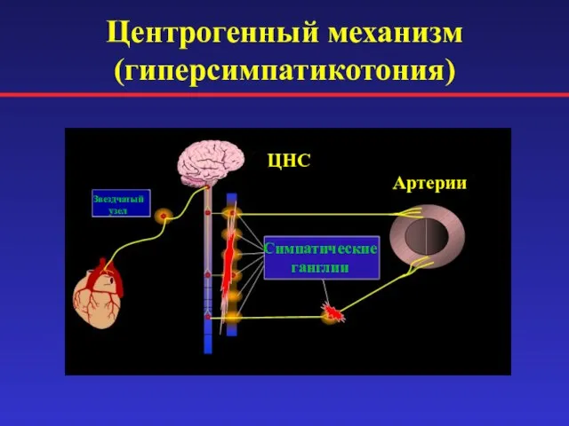 Центрогенный механизм (гиперсимпатикотония) Симпатические ганглии Звездчатый узел ЦНС Артерии