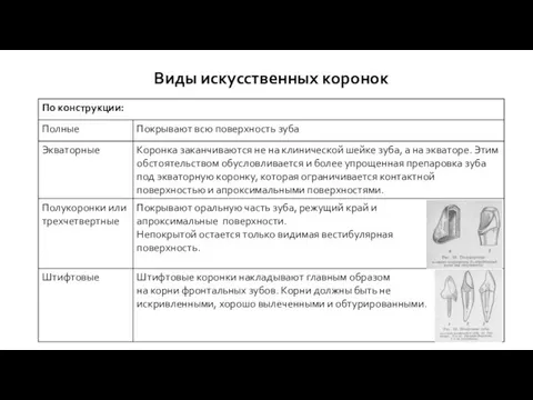 Виды искусственных коронок