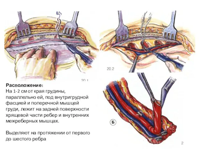 Расположение: На 1-2 см от края грудины, параллельно ей, под внутригрудной