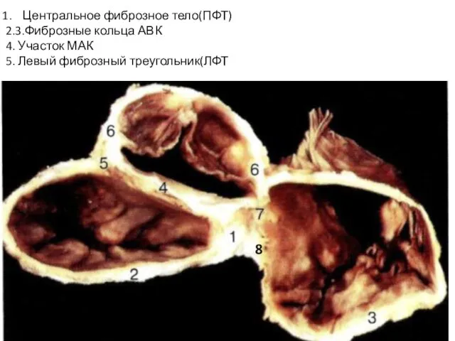 Центральное фиброзное тело(ПФТ) 2.3.Фиброзные кольца АВК 4. Участок МАК 5. Левый