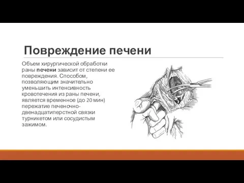 Повреждение печени Объем хирургической обработки раны печени зависит от степени ее