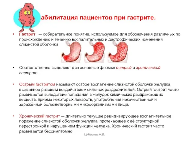 Реабилитация пациентов при гастрите. Гастрит — собирательное понятие, используемое для обозначения