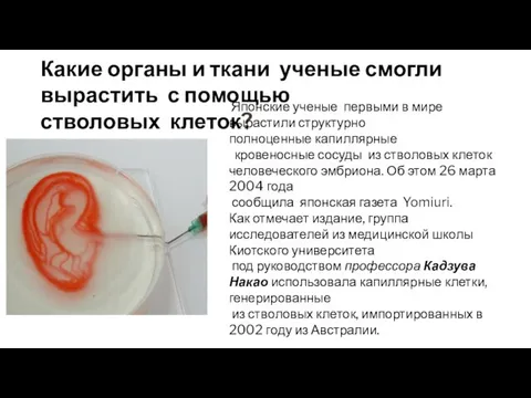 Какие органы и ткани ученые смогли вырастить с помощью стволовых клеток?