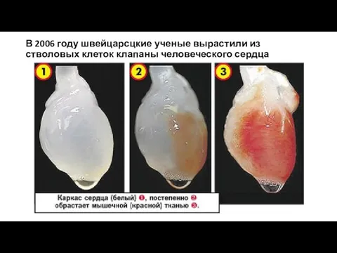 В 2006 году швейцарсцкие ученые вырастили из стволовых клеток клапаны человеческого сердца