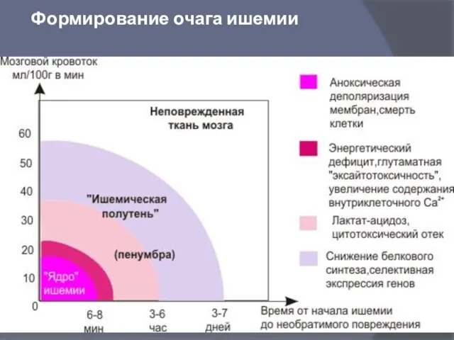 Формирование очага ишемии