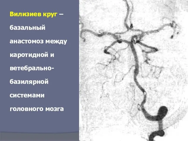 Вилизиев круг – базальный анастомоз между каротидной и ветебрально-базилярной системами головного мозга