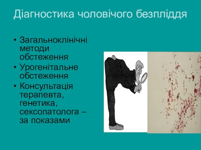 Діагностика чоловічого безпліддя Загальноклінічні методи обстеження Урогенітальне обстеження Консультація терапевта, генетика, сексопатолога – за показами