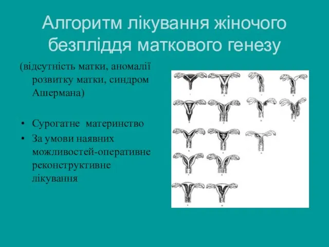 Алгоритм лікування жіночого безпліддя маткового генезу (відсутність матки, аномалії розвитку матки,