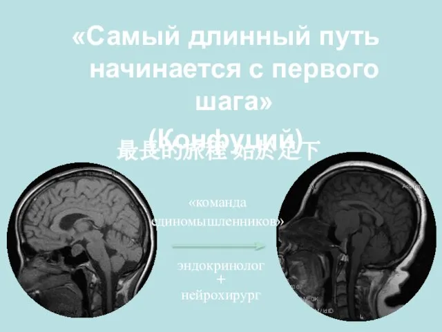 «Самый длинный путь начинается с первого шага» (Конфуций) 最長的旅程 始於足下 «команда единомышленников» эндокринолог + нейрохирург