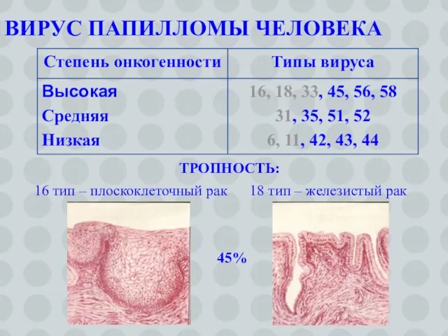 ВИРУС ПАПИЛЛОМЫ ЧЕЛОВЕКА ТРОПНОСТЬ: 16 тип – плоскоклеточный рак 18 тип – железистый рак 45%