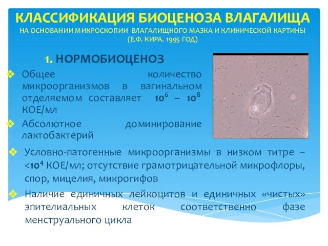 КЛАССИФИКАЦИЯ БИОЦЕНОЗА ВЛАГАЛИЩА НА ОСНОВАНИИ МИКРОСКОПИИ ВЛАГАЛИЩНОГО МАЗКА И КЛИНИЧЕСКОЙ КАРТИНЫ