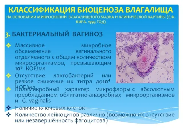 КЛАССИФИКАЦИЯ БИОЦЕНОЗА ВЛАГАЛИЩА НА ОСНОВАНИИ МИКРОСКОПИИ ВЛАГАЛИЩНОГО МАЗКА И КЛИНИЧЕСКОЙ КАРТИНЫ