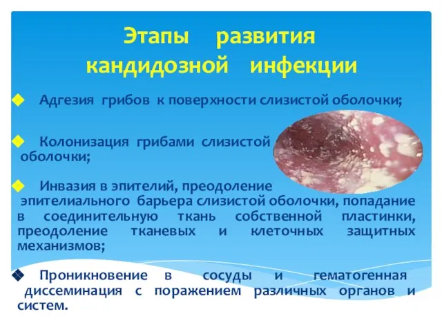 Этапы развития кандидозной инфекции Адгезия грибов к поверхности слизистой оболочки; Колонизация