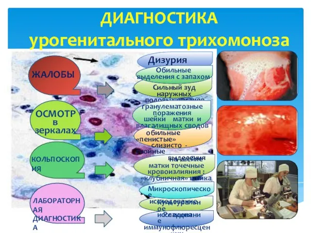 . ДИАГНОСТИКА урогенитального трихомоноза ЖАЛОБЫ Сильный зуд наружных половых органов Дизурия