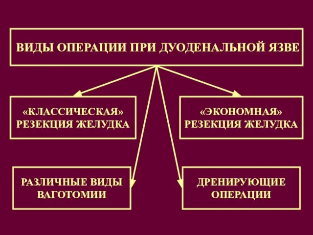 ВИДЫ ОПЕРАЦИИ ПРИ ДУОДЕНАЛЬНОЙ ЯЗВЕ «КЛАССИЧЕСКАЯ» РЕЗЕКЦИЯ ЖЕЛУДКА «ЭКОНОМНАЯ» РЕЗЕКЦИЯ ЖЕЛУДКА РАЗЛИЧНЫЕ ВИДЫ ВАГОТОМИИ ДРЕНИРУЮЩИЕ ОПЕРАЦИИ