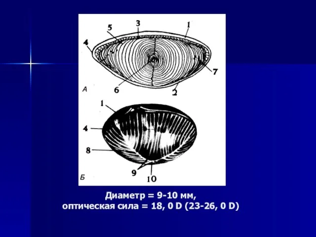 Диаметр = 9-10 мм, оптическая сила = 18, 0 D (23-26, 0 D)