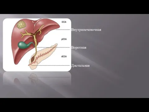 Внутрипеченочная Воротная Дистальная