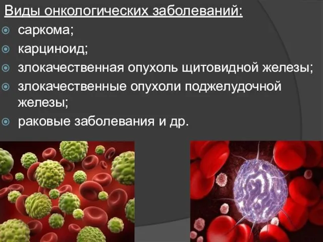 Виды онкологических заболеваний: саркома; карциноид; злокачественная опухоль щитовидной железы; злокачественные опухоли