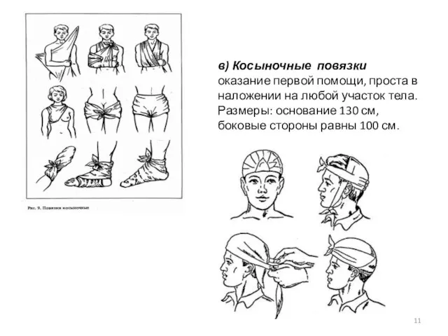 в) Косыночные повязки оказание первой помощи, проста в наложении на любой