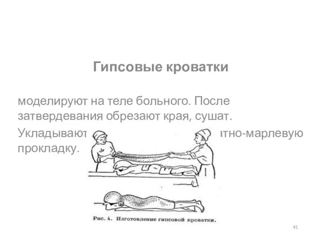 Гипсовые кроватки моделируют на теле больного. После затвердевания обрезают края, сушат. Укладывают пациента, подложив ватно-марлевую прокладку.