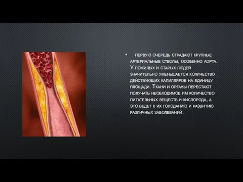 В первую очередь страдают крупные артериальные стволы, особенно аорта.У пожилых и