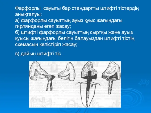 Фарфорлы сауыты бар стандартты штифті тістердің анықталуы: а) фарфорлы сауыттың ауыз