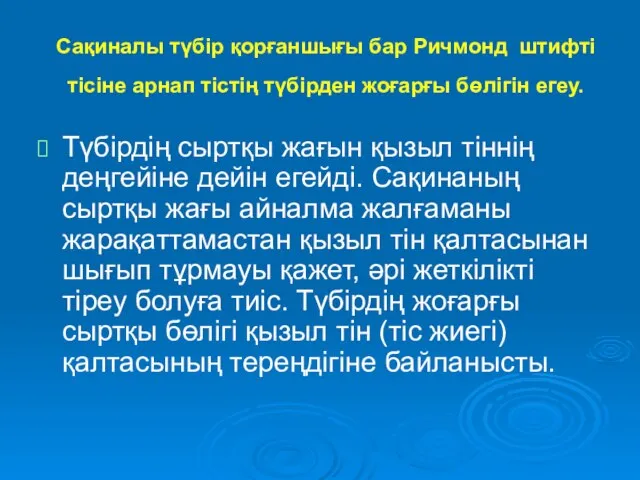 Сақиналы түбір қорғаншығы бар Ричмонд штифті тісіне арнап тістің түбірден жоғарғы