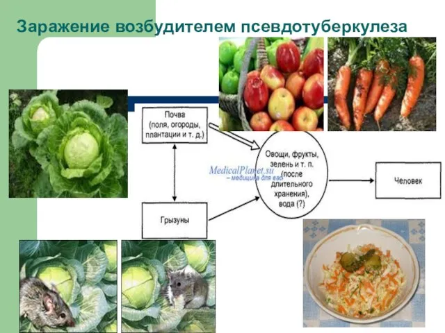 Заражение возбудителем псевдотуберкулеза