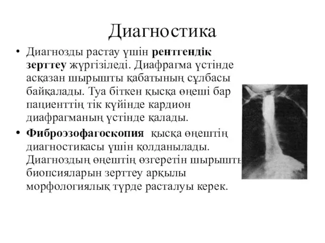 Диагностика Диагнозды растау үшін рентгендік зерттеу жүргізіледі. Диафрагма үстінде асқазан шырышты