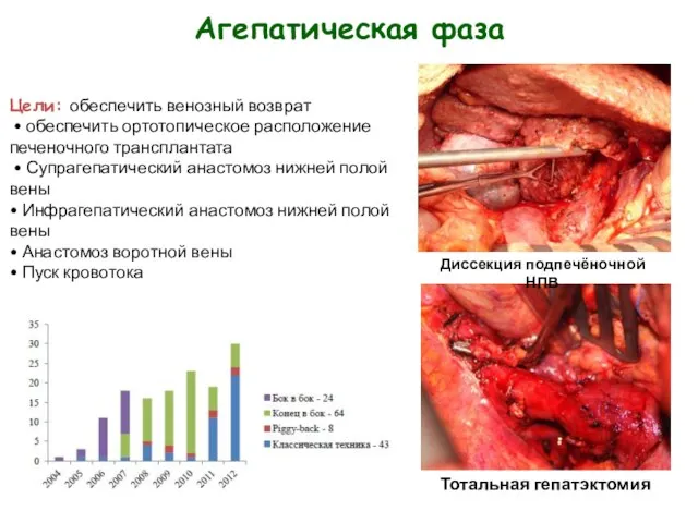 Агепатическая фаза Цели: обеспечить венозный возврат • обеспечить ортотопическое расположение печеночного