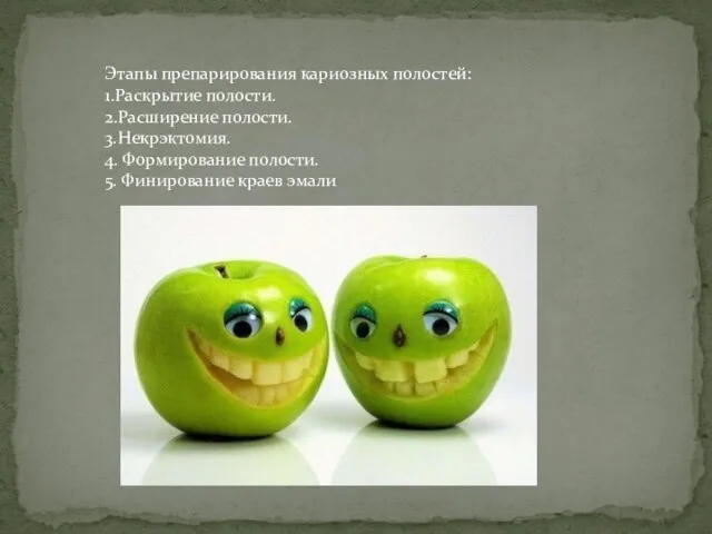 Этапы препарирования кариозных полостей: 1.Раскрытие полости. 2.Расширение полости. 3.Некрэктомия. 4. Формирование полости. 5. Финирование краев эмали